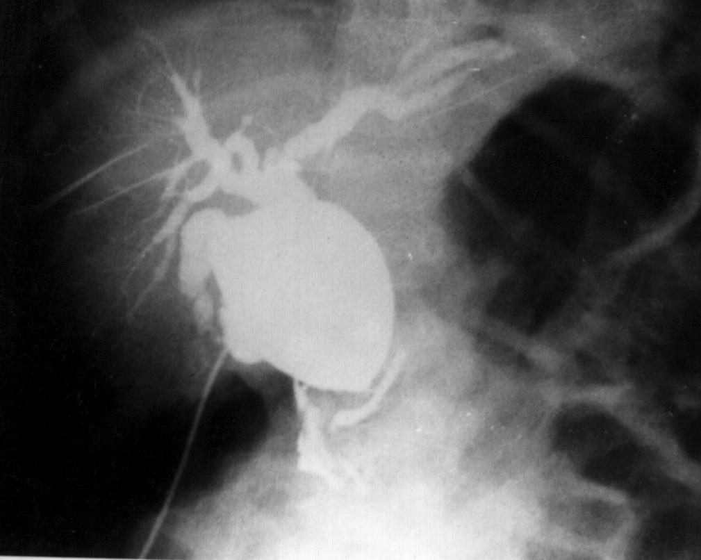 Cbd1.jpg (53776 bytes)