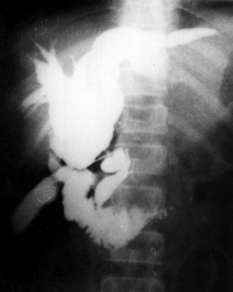 Cbd2.jpg (48471 bytes)