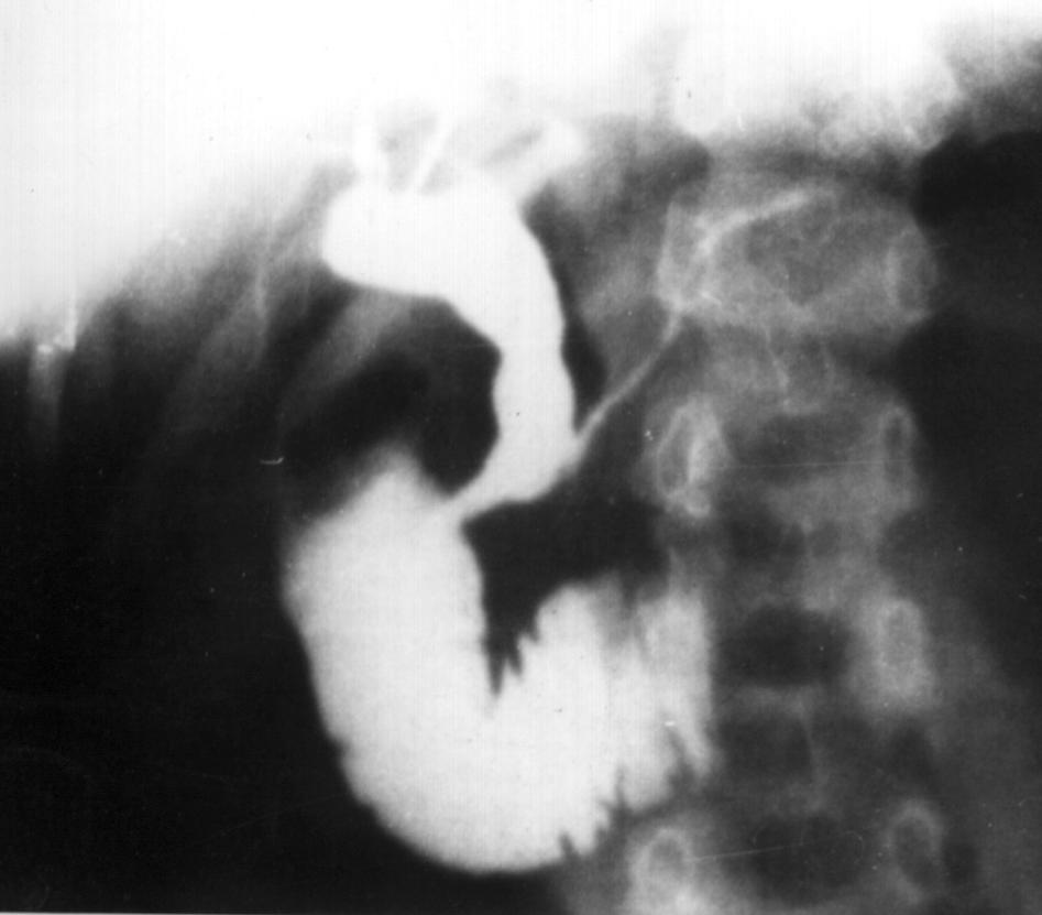 Cbd4.jpg (47472 bytes)