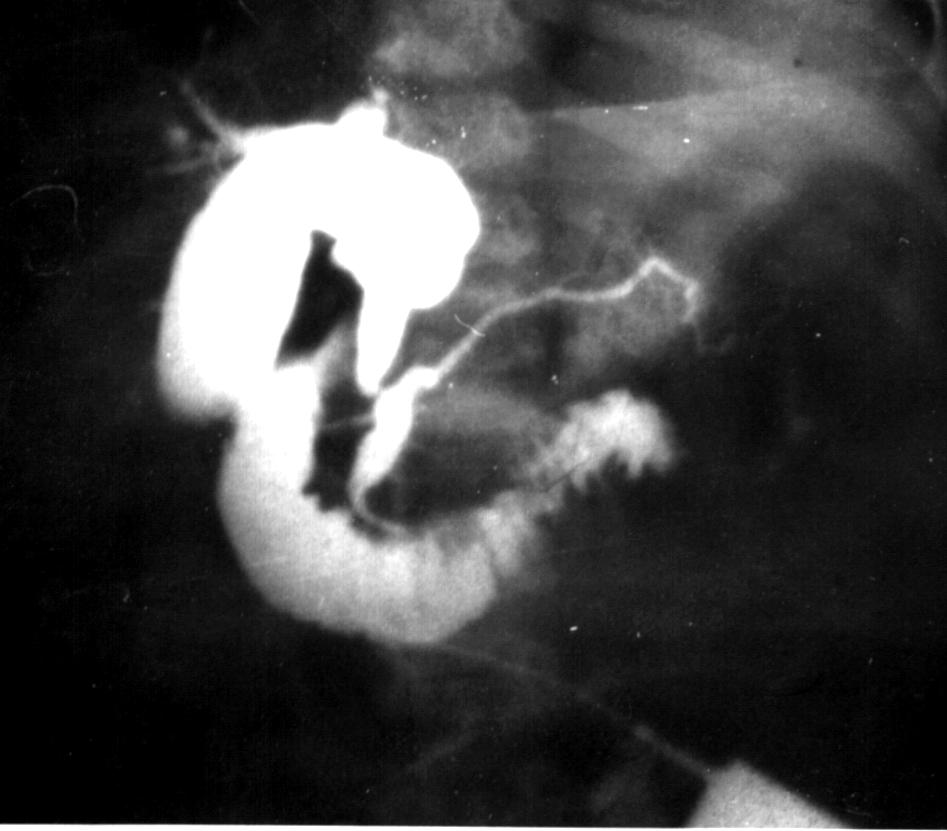 Cbd5.jpg (58933 bytes)